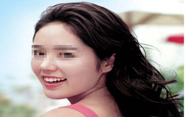 烏魯木齊哪家整形醫(yī)院的口碑比較好？