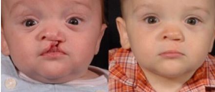 愛美人士必看！艾莉薇PK伊婉玻尿酸，功效、使用范圍、持久度對(duì)比