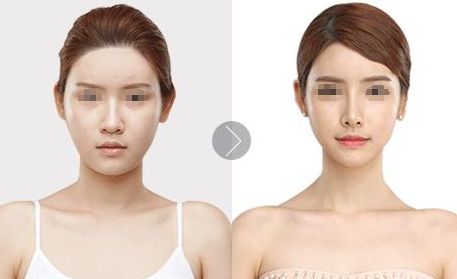 北京植發(fā)醫(yī)院推薦，哪家效果好？