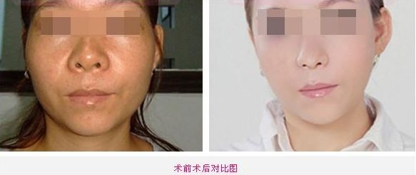 全新整容醫(yī)院推薦！這5家值得你關(guān)注