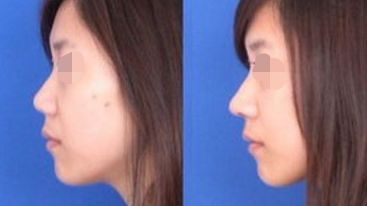 中山地區(qū)五家受網(wǎng)友認可的專業(yè)整形醫(yī)院