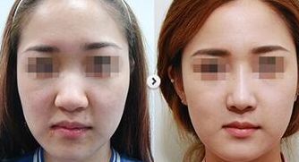 集安知名整形診所徐秀云外科口碑如何？收費標準和服務詳情揭秘