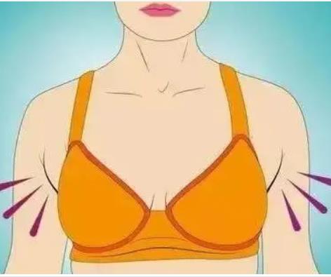 副乳切除后需住院？是否住院是必要的？