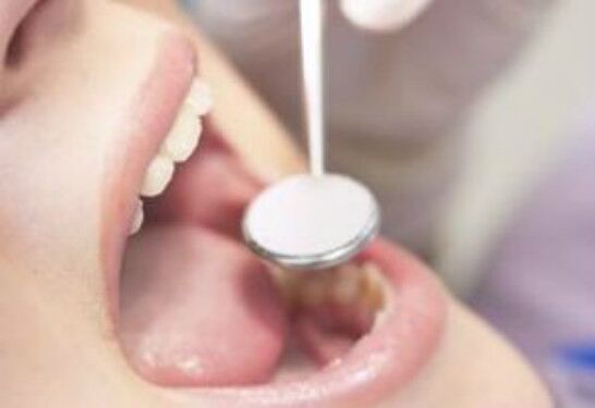 洛陽(yáng)耳贅整形醫(yī)生