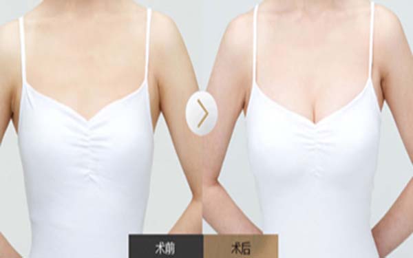 重慶眼部皺紋整形醫(yī)生