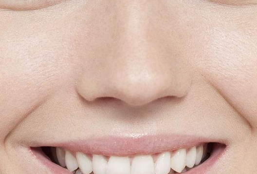 石家莊黃金面部微雕醫(yī)生