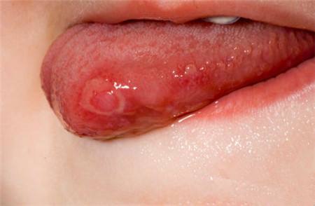 信陽(yáng)精雕瘦腰部醫(yī)生