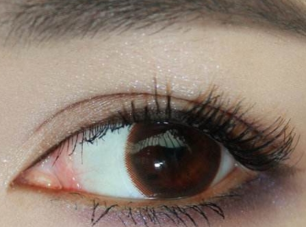 大連E光去除妊娠紋醫(yī)生