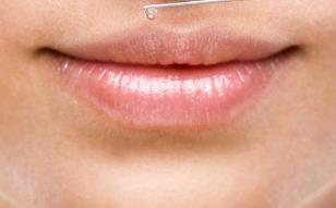 長沙眼角緊致提拉醫(yī)生