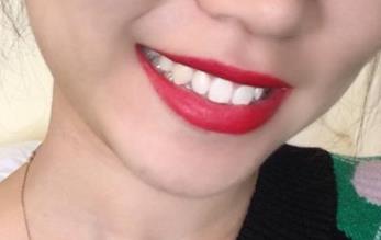 青島面部填充醫(yī)生