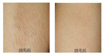 濰坊YS立挺鼻整醫(yī)生