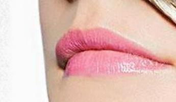 秦皇島精雕祛眼周紋醫(yī)生