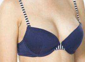 長沙手術祛除眉間紋醫(yī)生