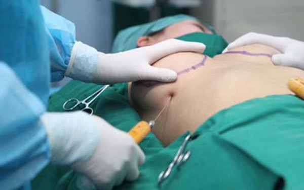 天津背部吸脂瘦身醫(yī)生