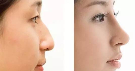 宜興韓式除皺手術醫(yī)生