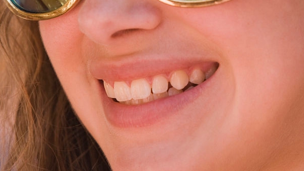 寧波物理去面部皺紋醫(yī)生