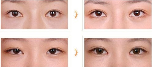 南陽眼鼻修復(fù)再造醫(yī)生