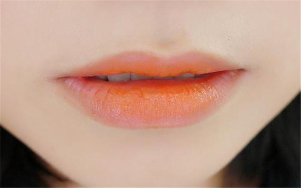 煙臺微雕去除額頭紋醫(yī)生