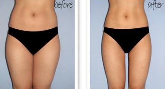 恩施玻尿酸填充眼部細(xì)紋醫(yī)生