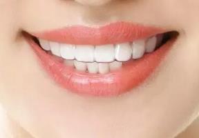 重慶納美雙眼皮醫(yī)生