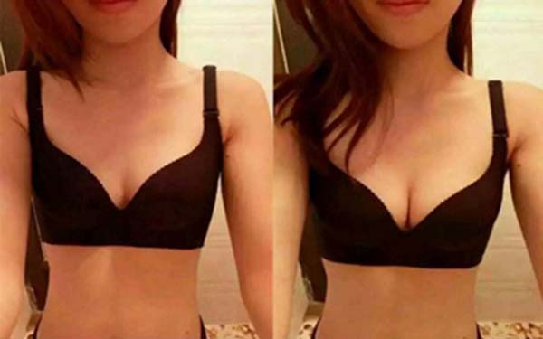 阜陽(yáng)乳頭肥大醫(yī)生