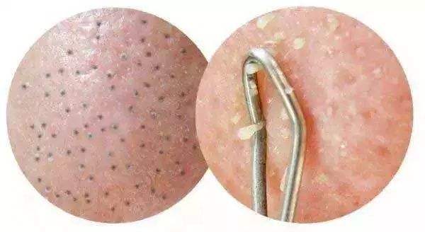 蕪湖韓式唯美無痕隆胸醫(yī)生