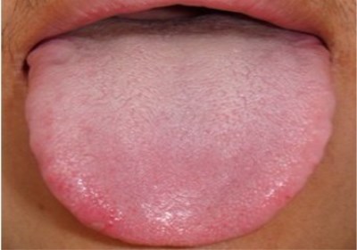 江門肉毒素填充靜態(tài)紋醫(yī)生