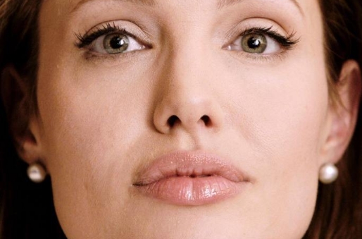 瀘州除皺針祛眼睛細(xì)紋醫(yī)生