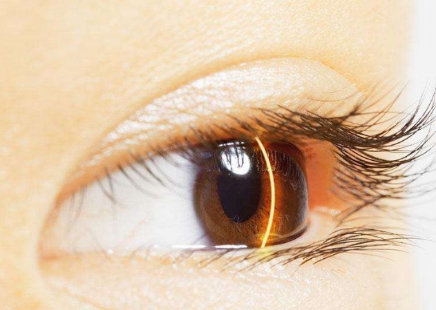 武漢眼睛細(xì)紋注射填充醫(yī)生