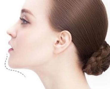 長沙玻尿酸填充眼角紋醫(yī)生