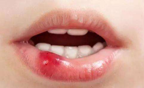 天津注射豐蘋果肌醫(yī)生