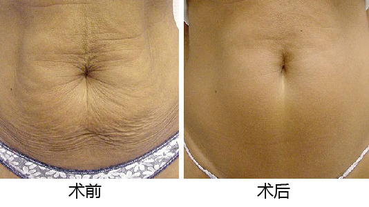 2023南京隆鼻醫(yī)院綜合排行：韓辰問鼻亞軍奪冠！價(jià)目明晰，快來了解！