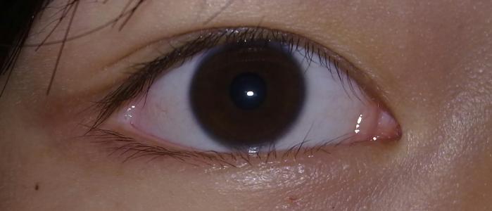 2023內江市口碑出眾的隆胸醫(yī)院大揭秘