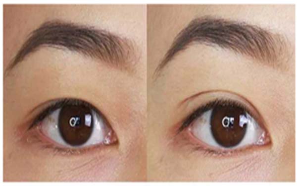 2023年亳州地區(qū)最受矚目的吸脂手術(shù)醫(yī)院盤點，前三強醫(yī)院非常值得關(guān)注！