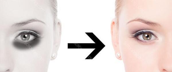 2023年中國整形醫(yī)院磨骨術(shù)排名榜單，重慶時(shí)光引人矚目