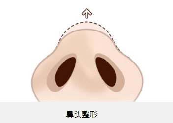 2023年北京治療疤痕的頂尖整形醫(yī)院排名出爐，紛紛爭奪前八！公立vs私立，只為你的美麗轉(zhuǎn)變！