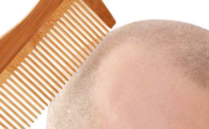 2023年南京口腔矯正醫(yī)院排行榜公布！這三家醫(yī)院上榜了！