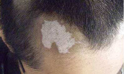 2023年襄陽(yáng)整形醫(yī)院治療匯總，推薦排名前八，韓寇位列第五，維多利亞穩(wěn)居前三！