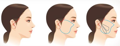 2023年淮安整形醫(yī)院近五年中綜合回顧，美麗殿堂華麗揭幕，蘇王獨(dú)領(lǐng)前列！