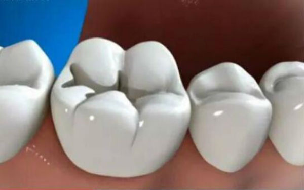 2023年玉林植發(fā)醫(yī)院最受關(guān)注的五家醫(yī)院再度揭曉！聽(tīng)聽(tīng)網(wǎng)友對(duì)第一名的驚人評(píng)價(jià)