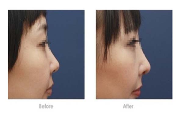 2023年長沙頂級整形醫(yī)院盤點：卓越、芳華、華麗居榜單前列！