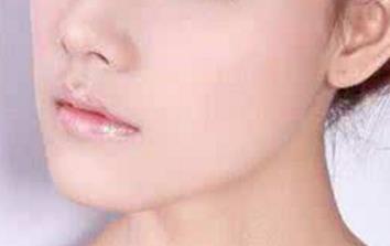 寧波光纖熱塑溶脂醫(yī)生