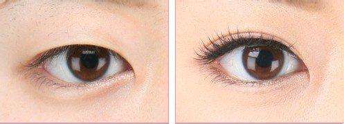 上海專家推薦：首爾麗格、虹橋醫(yī)院為你的祛疤首選！