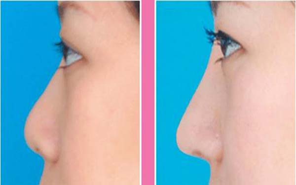 九院醫(yī)生推薦：無(wú)論是李青峰還是張余光，都是面部提升領(lǐng)域的頂尖專家！