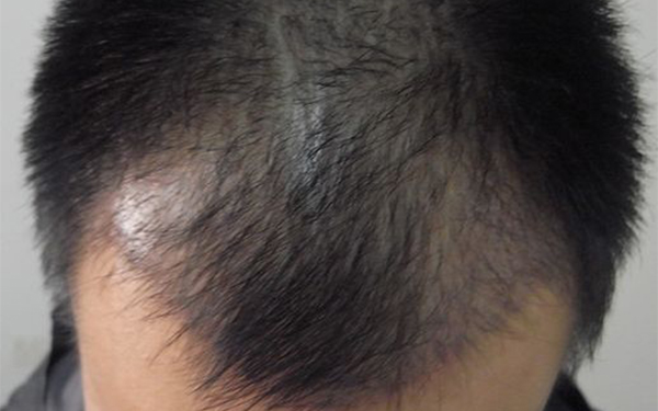 臨沂公立口腔醫(yī)院一覽：多家機(jī)構(gòu)備受贊譽(yù)，靠譜口碑讓您舉措輕松！確?？谇唤】担焖龠x擇最佳！