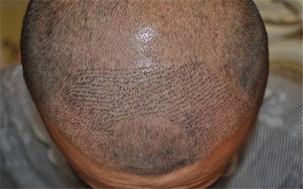 東方美萊塢、永美等四強醫(yī)美上榜！安徽亳州整形醫(yī)院最新匯總表公布