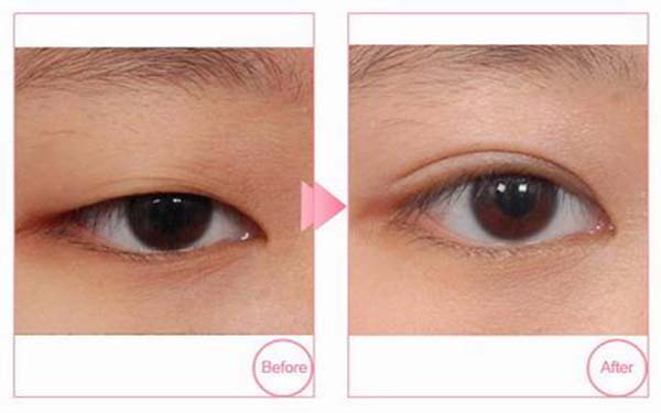 上海五家優(yōu)質(zhì)祛斑美容醫(yī)院盤點