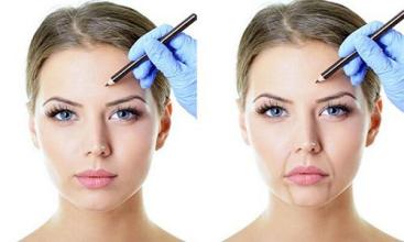 北京納米微針去頸部皺紋醫(yī)生