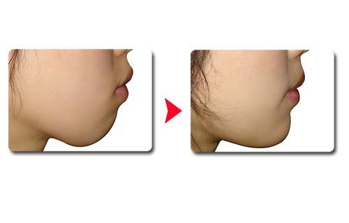 東方美萊塢推出最新臨雙眼皮整形醫(yī)院清單，眾評(píng)盛贊其技術(shù)實(shí)力！