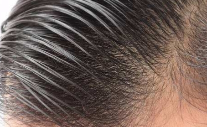 【2023年最佳整容醫(yī)院】重慶地區(qū)前十強(qiáng)推薦，不容錯(cuò)過！點(diǎn)擊收藏參考！